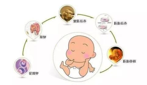 泰國三代試管嬰兒費用詳解，讓您心里有數！（附成功率及費用詳情）